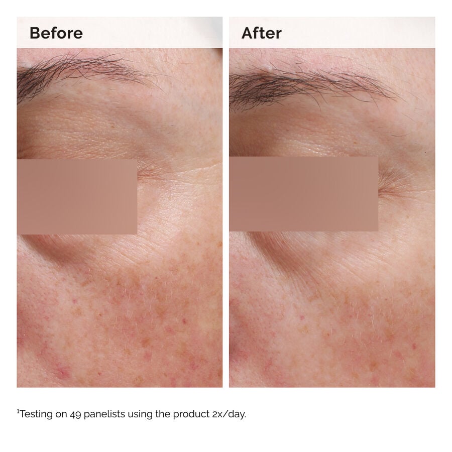 niacinamide-5-face-and-body-emulsion-n1 2024-08-23-ORD-Nia-5pct-Face-Body-B-A-Elasticity-Global-02-1x1.jpg