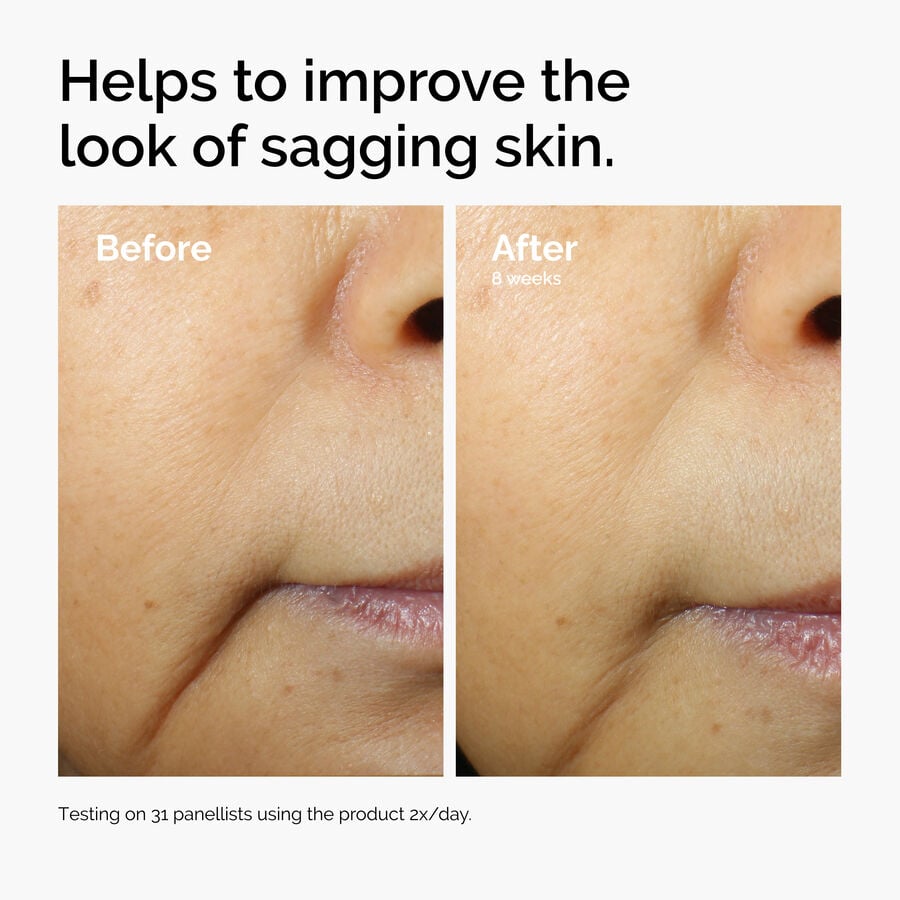 caffeine-3-escin-1-face-serum-h4 ord-caffeine-3pct-escin-1pct-face-serum-before-after-sagging.jpg