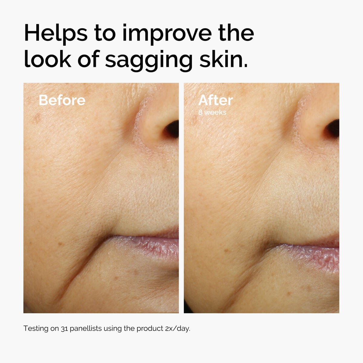 caffeine-3-escin-1-face-serum-h4 ord-caffeine-3pct-escin-1pct-face-serum-before-after-sagging.jpg