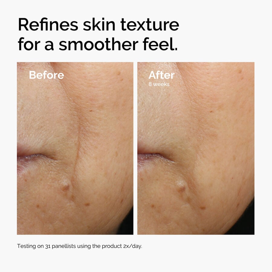 caffeine-3-escin-1-face-serum-h4 ord-caffeine-3pct-escin-1pct-face-serum-before-after-texture.jpg