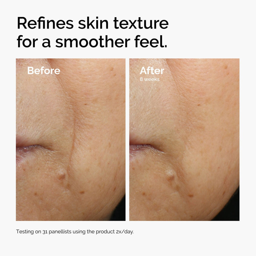 caffeine-3-escin-1-face-serum-h4 ord-caffeine-3pct-escin-1pct-face-serum-before-after-texture.jpg