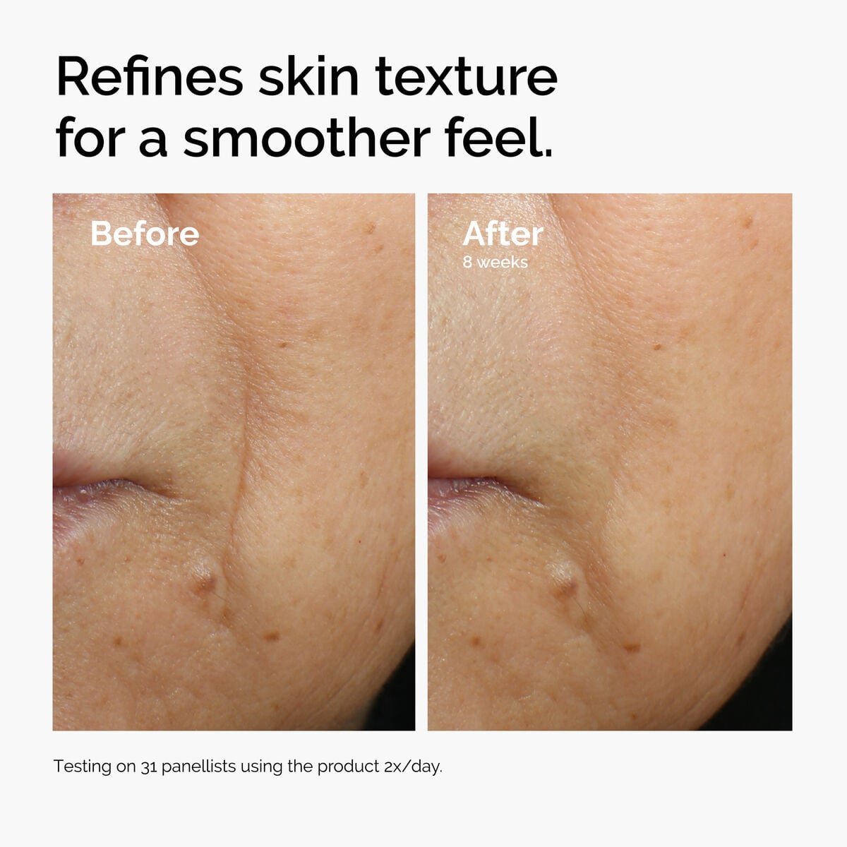 caffeine-3-escin-1-face-serum-h4 ord-caffeine-3pct-escin-1pct-face-serum-before-after-texture.jpg