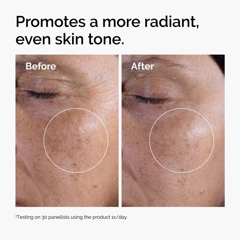 glycolic-acid-7-exfoliating-toner-g5 ord-glycolic-before-after-radiance.jpg