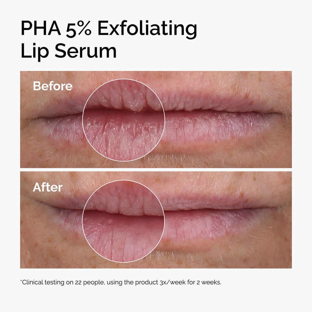pha-5-exfoliating-lip-serum-n4 ord-pha-5pct-lip-exfoliating-serum-before-after.jpg
