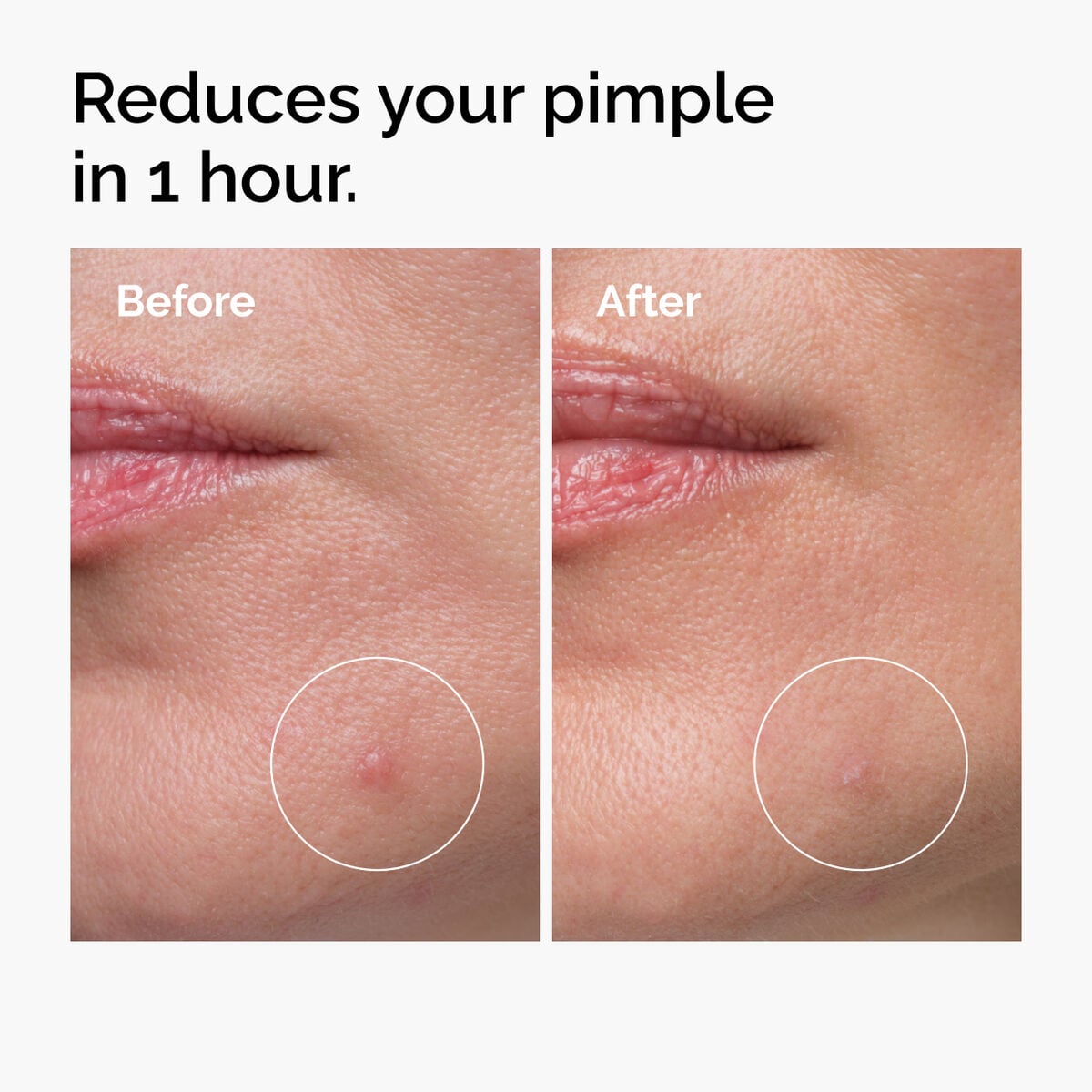 sulfur-10-powder-to-cream-concentrate-m0 ord-sulfur-10pct-powder-to-cream-concentrate-before-after-NA.jpg