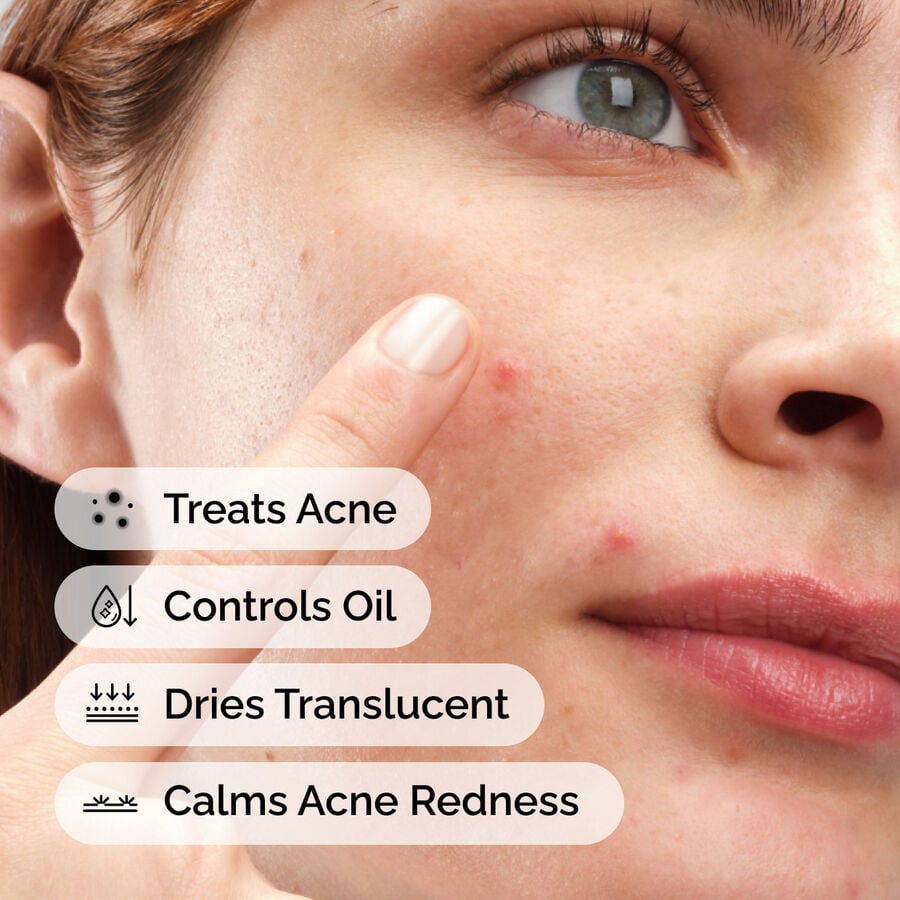 sulfur-10-powder-to-cream-concentrate-m0 ord-sulfur-10pct-powder-to-cream-concentrate-model-application-with-benefits-acne.jpg